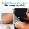 Dermasuri Deep Exfoliating Glove - Exfoliating Mitt Body Scrubber - Korean Skin Scrubber Exfoliator & Dead Skin Remover - Keratosis Pilaris Scrub - Spray Tan Remover - Shower Skincare (1 Pack) - Image 4